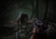SCORN Deluxe Edition